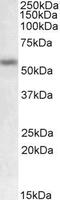 Matrix Metallopeptidase 12 antibody, GTX88142, GeneTex, Western Blot image 