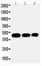 Indian Hedgehog Signaling Molecule antibody, PA2225, Boster Biological Technology, Western Blot image 