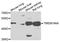 Transmembrane Protein 184A antibody, A7857, ABclonal Technology, Western Blot image 