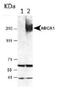 ATP Binding Cassette Subfamily A Member 1 antibody, PA1-32129, Invitrogen Antibodies, Western Blot image 