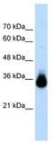 Homeobox protein Hox-C9 antibody, TA339140, Origene, Western Blot image 