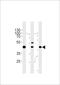 GTF2H2 Family Member C, Copy 2 antibody, A19016-1, Boster Biological Technology, Western Blot image 