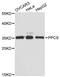 Phosphopantothenoylcysteine Synthetase antibody, LS-C747899, Lifespan Biosciences, Western Blot image 