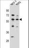 Kruppel Like Factor 4 antibody, LS-C203673, Lifespan Biosciences, Western Blot image 