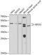 Eukaryotic Translation Initiation Factor 2 Subunit Beta antibody, GTX33171, GeneTex, Western Blot image 