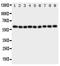 IL-5R-alpha antibody, PA1619, Boster Biological Technology, Western Blot image 