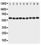 Interleukin 5 Receptor Subunit Alpha antibody, PA1619, Boster Biological Technology, Western Blot image 