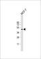 Trans-Golgi network integral membrane protein 2 antibody, 63-719, ProSci, Western Blot image 