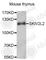 Mtr4 Exosome RNA Helicase antibody, A4560, ABclonal Technology, Western Blot image 