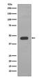 Keratin 14 antibody, M01432-1, Boster Biological Technology, Western Blot image 