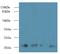 Mitochondrial Ribosomal Protein L18 antibody, A59850-100, Epigentek, Western Blot image 