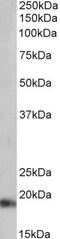 Unc-51 Like Kinase 3 antibody, 42-905, ProSci, Western Blot image 