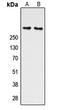 ATM Serine/Threonine Kinase antibody, LS-C358421, Lifespan Biosciences, Western Blot image 