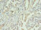 Inosine Monophosphate Dehydrogenase 2 antibody, CSB-PA011701LA01HU, Cusabio, Immunohistochemistry frozen image 