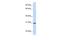 Stanniocalcin 1 antibody, PA5-42104, Invitrogen Antibodies, Western Blot image 