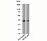 RUNX Family Transcription Factor 3 antibody, N1190-100UG, NSJ Bioreagents, Western Blot image 