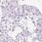 Insulin Like Growth Factor Binding Protein 1 antibody, PA5-61388, Invitrogen Antibodies, Immunohistochemistry frozen image 