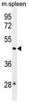 NOP2/Sun RNA Methyltransferase 3 antibody, AP52943PU-N, Origene, Western Blot image 