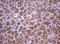 TNF Receptor Superfamily Member 8 antibody, LS-C789295, Lifespan Biosciences, Immunohistochemistry paraffin image 