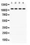 Protein Tyrosine Phosphatase Non-Receptor Type 22 antibody, PA5-79897, Invitrogen Antibodies, Western Blot image 