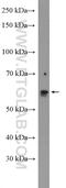 N-Acylsphingosine Amidohydrolase 1 antibody, 11274-1-AP, Proteintech Group, Western Blot image 