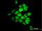 Serine/Threonine Kinase 33 antibody, H00065975-M09, Novus Biologicals, Immunocytochemistry image 