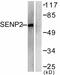 Sentrin-specific protease 2 antibody, ab58418, Abcam, Western Blot image 