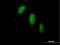 Tigger Transposable Element Derived 1 antibody, H00200765-B01P, Novus Biologicals, Immunofluorescence image 