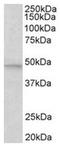 Mitogen-Activated Protein Kinase 9 antibody, AP31957PU-N, Origene, Western Blot image 