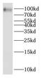 Otopetrin 3 antibody, FNab06038, FineTest, Western Blot image 