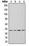 Inhibin Subunit Beta A antibody, LS-C352375, Lifespan Biosciences, Western Blot image 