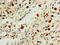 Histone Cluster 1 H1 Family Member B antibody, LS-C673224, Lifespan Biosciences, Immunohistochemistry paraffin image 