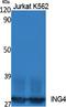 Inhibitor Of Growth Family Member 4 antibody, A02664-1, Boster Biological Technology, Western Blot image 