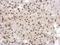 General Transcription Factor IIA Subunit 1 antibody, GTX117420, GeneTex, Immunohistochemistry paraffin image 