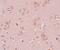Pleckstrin Homology Domain Containing M3 antibody, A16310, Boster Biological Technology, Immunohistochemistry paraffin image 