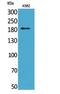 Sialic Acid Binding Ig Like Lectin 1 antibody, A05186, Boster Biological Technology, Western Blot image 