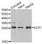 Oxidized low-density lipoprotein receptor 1 antibody, MBS128038, MyBioSource, Western Blot image 