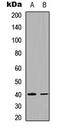 Tissue Specific Transplantation Antigen P35B antibody, LS-C358376, Lifespan Biosciences, Western Blot image 
