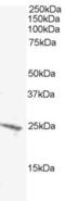 BCL2 Antagonist/Killer 1 antibody, EB05329, Everest Biotech, Western Blot image 