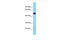 Transmembrane Protein 39A antibody, ARP68707_P050, Aviva Systems Biology, Western Blot image 