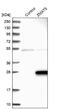 Zinc Finger Matrin-Type 5 antibody, NBP1-85794, Novus Biologicals, Western Blot image 