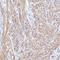 Tropomyosin 1 antibody, NBP1-89896, Novus Biologicals, Immunohistochemistry frozen image 