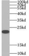Serotonin N-acetyltransferase antibody, FNab00020, FineTest, Western Blot image 