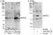 Mitogen-Activated Protein Kinase 6 antibody, A302-654A, Bethyl Labs, Western Blot image 