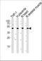 Corepressor Interacting With RBPJ, 1 antibody, A07268, Boster Biological Technology, Western Blot image 