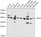 Eukaryotic Translation Initiation Factor 3 Subunit H antibody, GTX65925, GeneTex, Western Blot image 