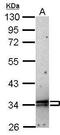 G18 antibody, GTX100216, GeneTex, Western Blot image 