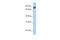 Gamma-Glutamyltransferase 7 antibody, 26-381, ProSci, Enzyme Linked Immunosorbent Assay image 