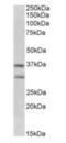 Fibroblast Growth Factor 23 antibody, NB100-55423, Novus Biologicals, Western Blot image 