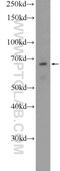 CAP-Gly Domain Containing Linker Protein Family Member 4 antibody, 17044-1-AP, Proteintech Group, Western Blot image 